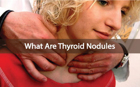 Where can you go to find images of thyroid nodules?