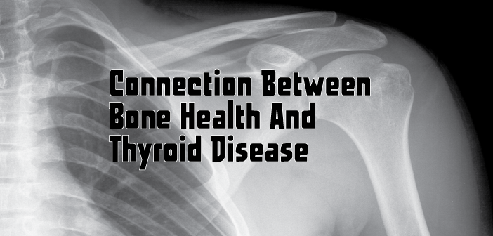 The-Connection-Between-Bone-Health-And-Thyroid-Disease