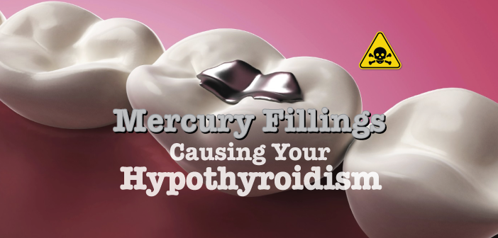 Mercury-Fillings-Causing-Your-Hypothyroidism