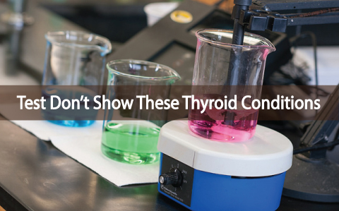 Tests-Don't-Show-These-6-Thyroid-Conditions