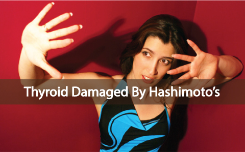 Your-Thyroid-Can-Be-Damaged-By-Hashimoto's