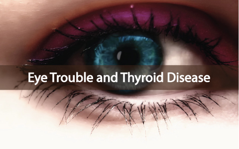 Trouble With Your Eyes? Maybe It's Thyroid Disease