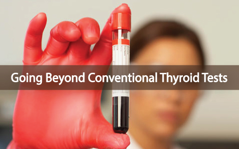 4-Useful-Blood-Tests-Going-Beyond-Conventional-Thyroid-Tests