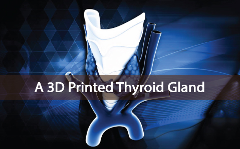 A-3D-Printed-Thyroid-Gland-Announced-In-Russia-First-Ever