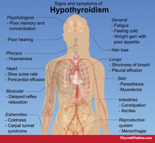 Signs-and-Symptoms-Meme-Thyroid-Nation
