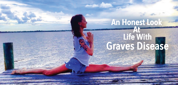 An-Honest-Look-At-Life-With-Graves-Disease